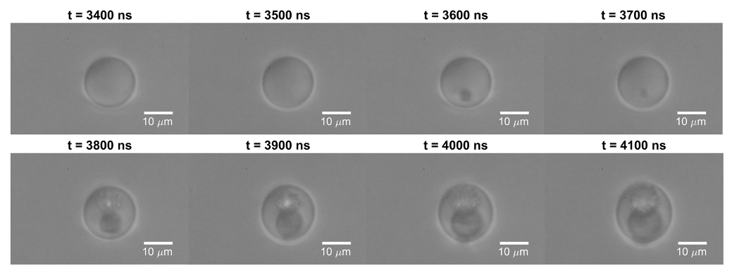 Enlarged view: Acoustic droplet vaporization of a perfluoropentane droplet.